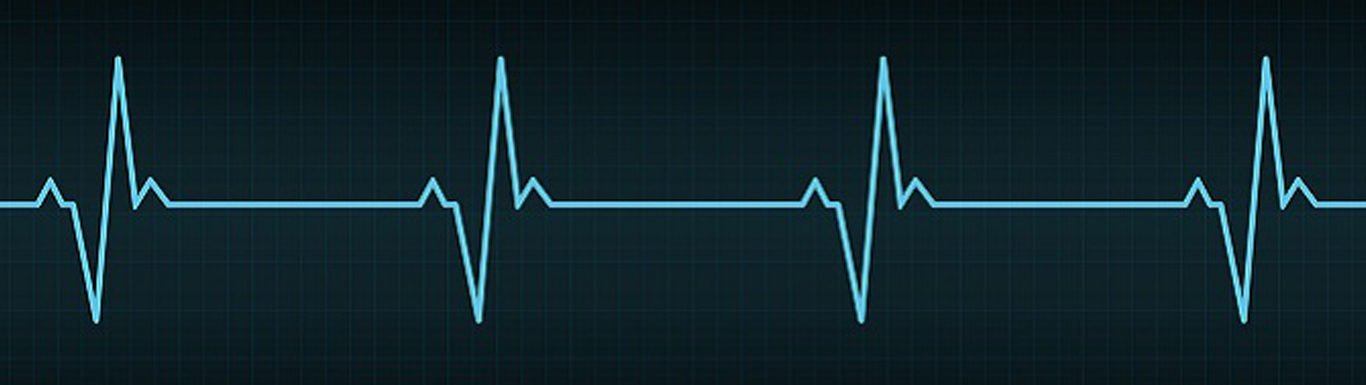 ecg
